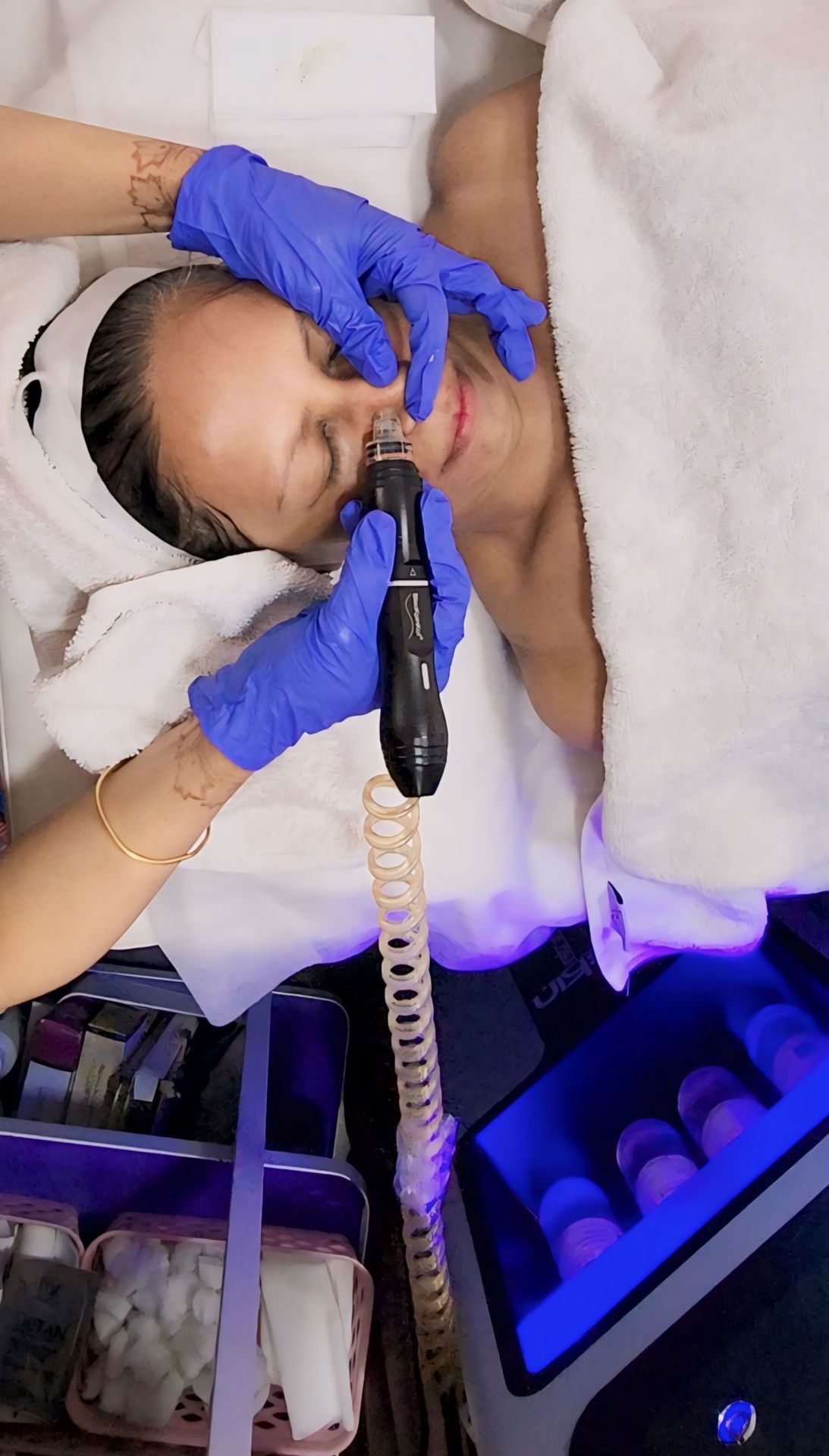 HYDRAFACIAL 