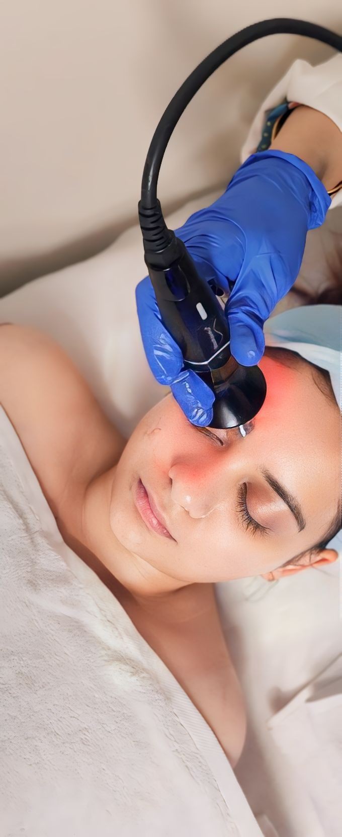 Radio-frequency (RF) skin Treatment 